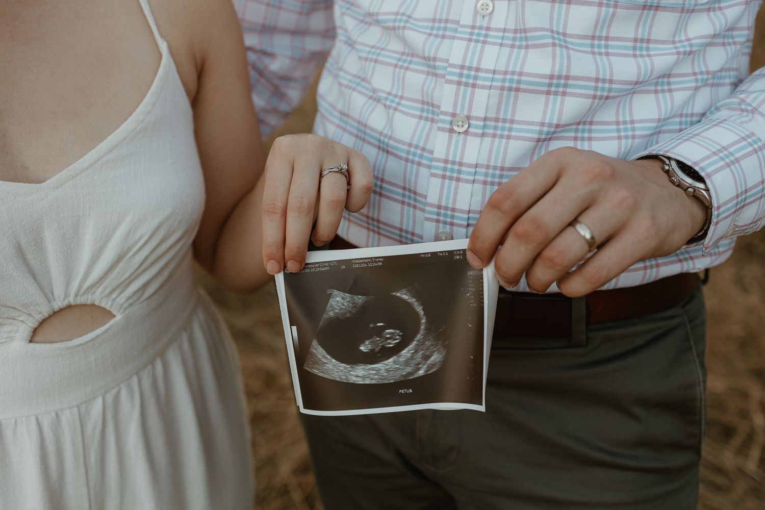 Couple holding ultrasound photo together in casual outdoor setting.