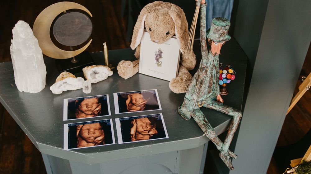 Display of 3D ultrasound photos with stuffed bunny, crystals, and whimsical doll figurine.