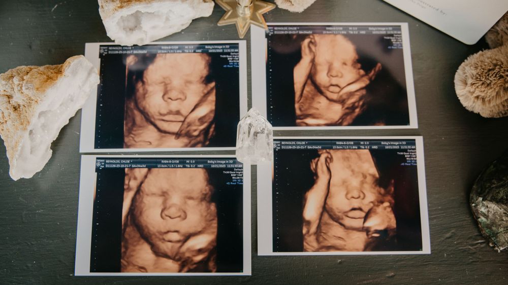 Four 3D ultrasound photos of Baby Blatt arranged on dark surface with decorative shells.