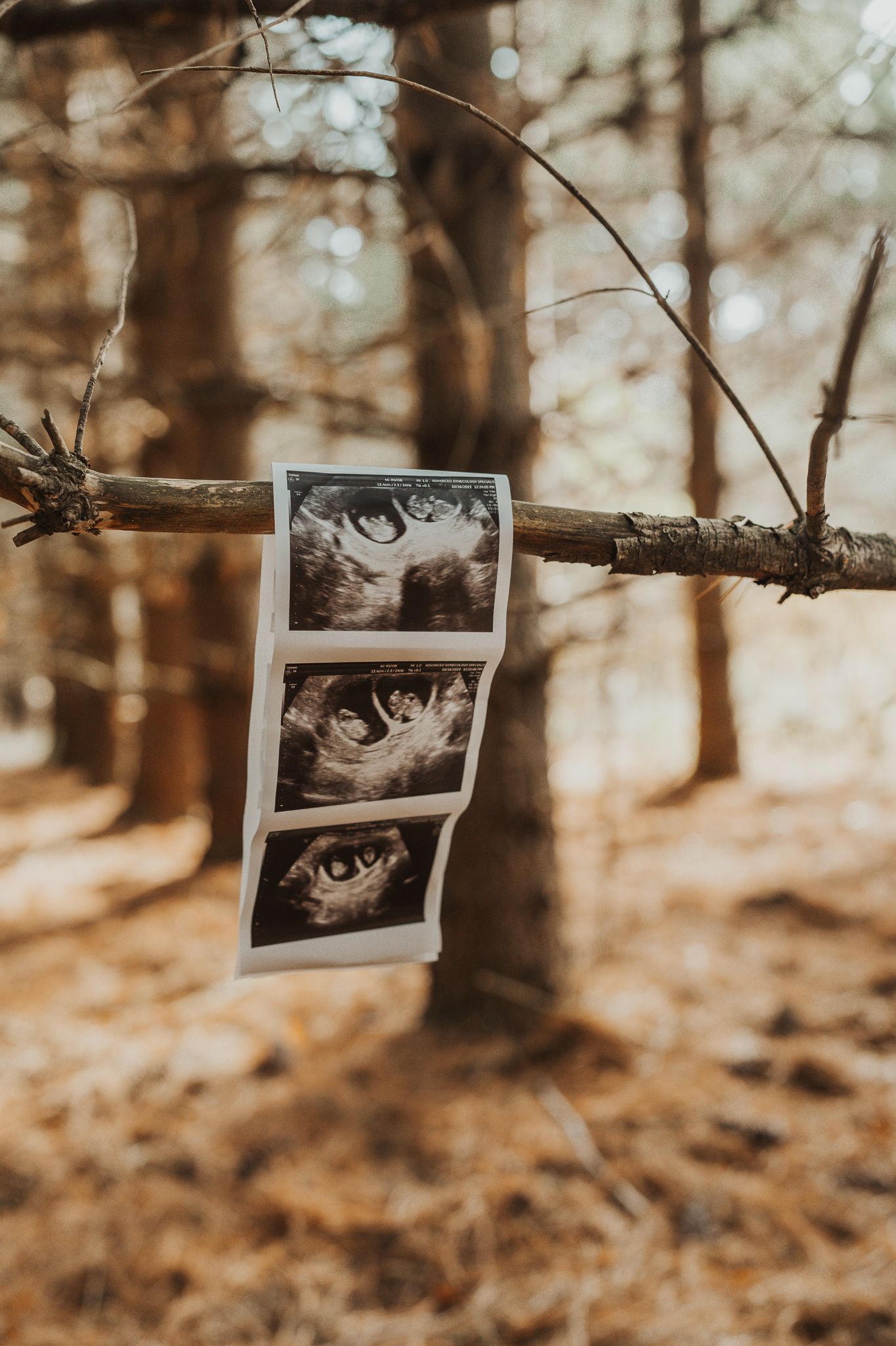 Ultrasound photos hanging from tree branch in sunlit autumn forest.