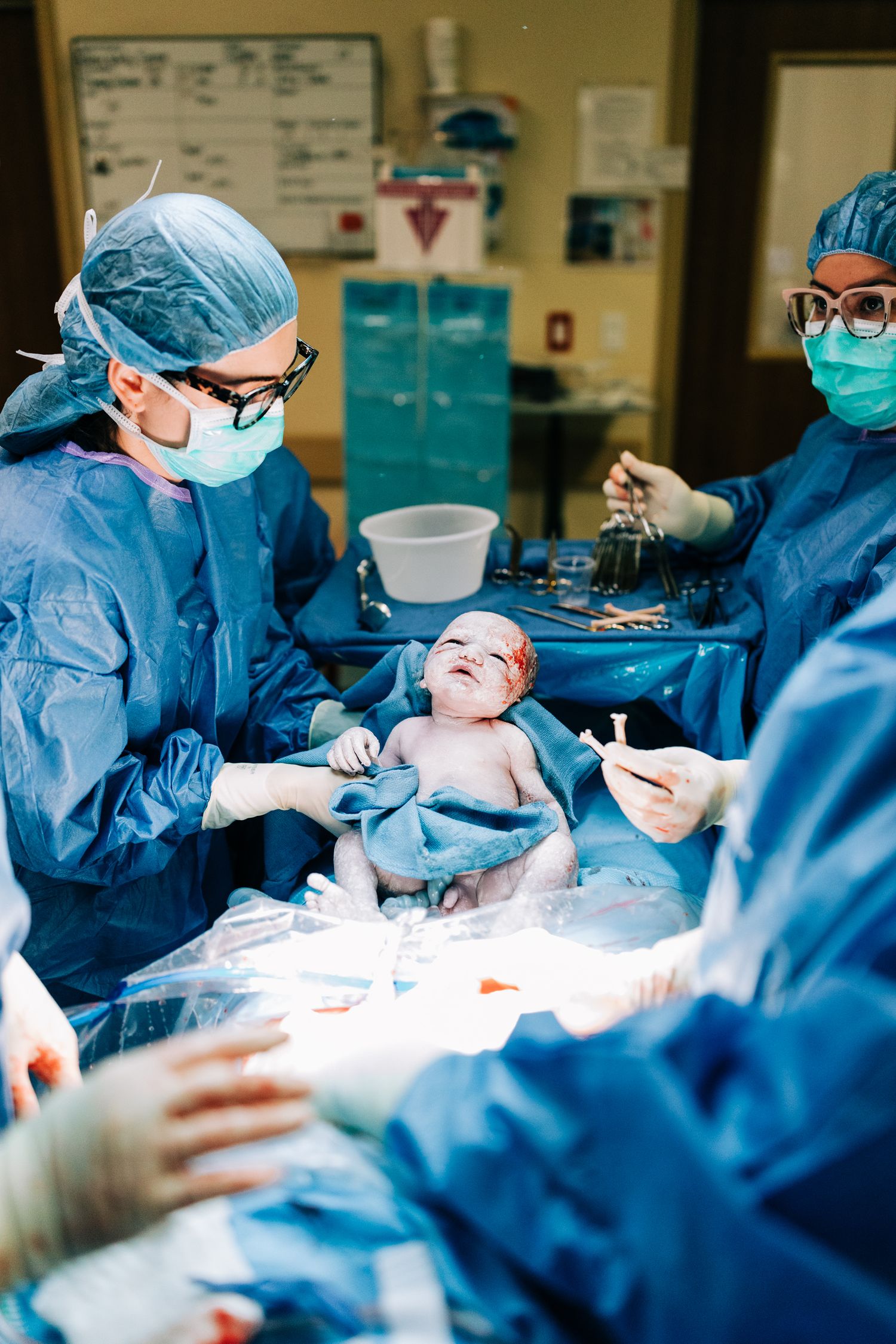 Baby boy just born via c-section, Santa Maria, CA