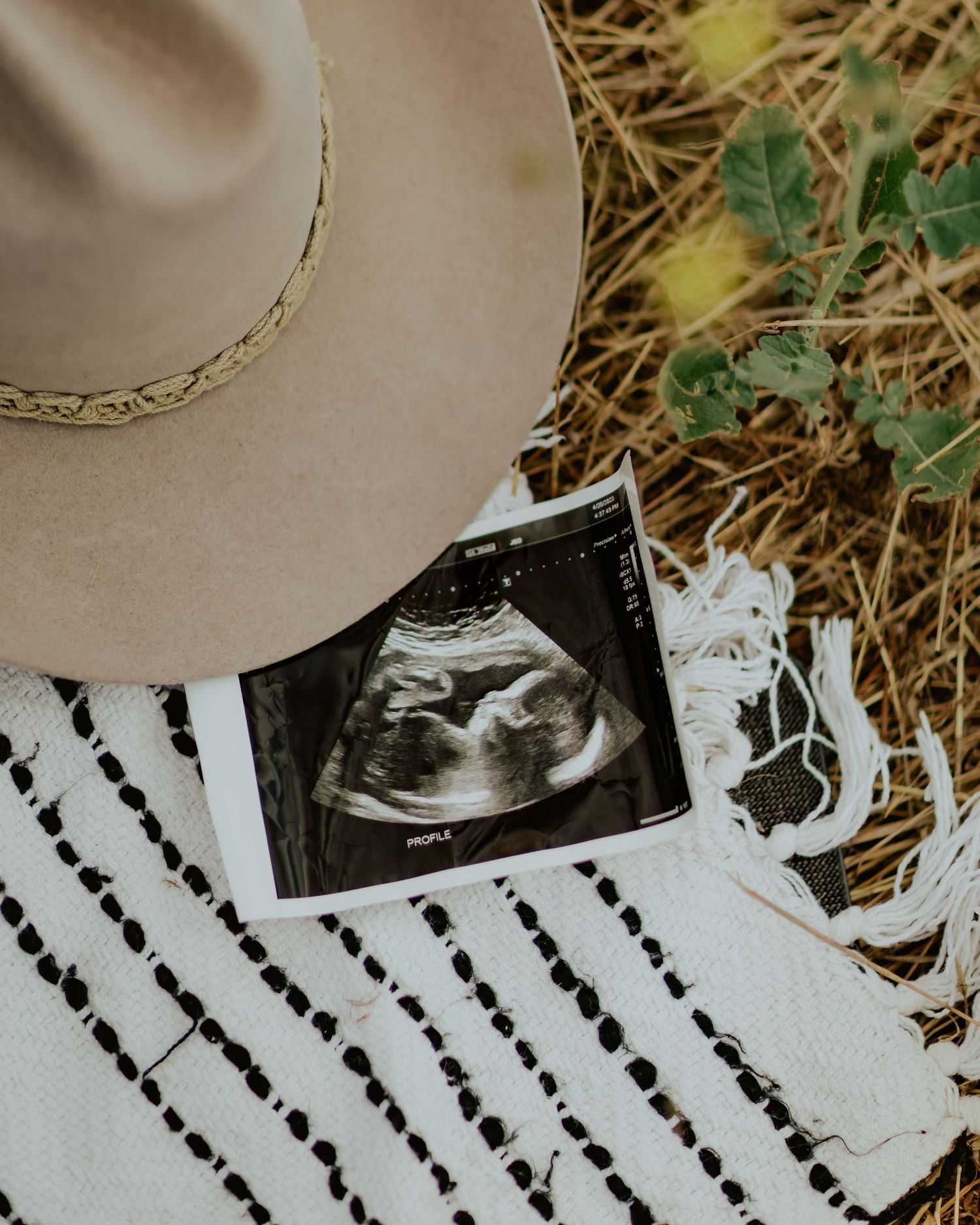 Pregnancy announcement photography of ultrasound in a field in Riverside, California