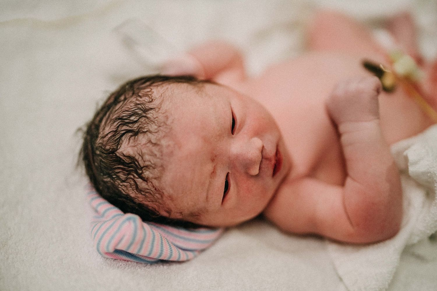 Fresh newborn baby with wet hair rests on white hospital blanket after delivery.