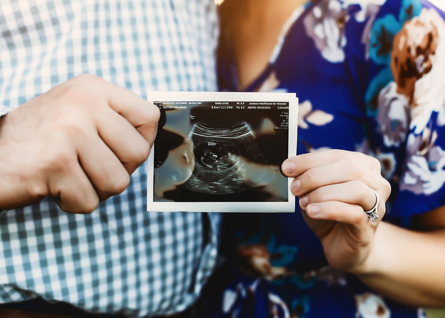 Hands hold up an ultrasound photo during a pregnancy announcement shoot.