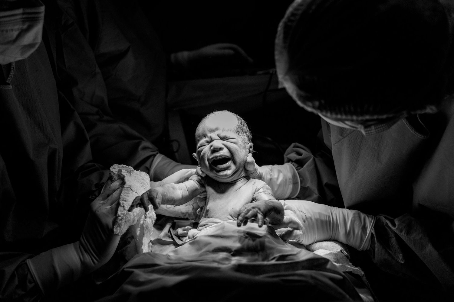 A dramatic black and white photograph captures a newborn's first cry in the delivery room.