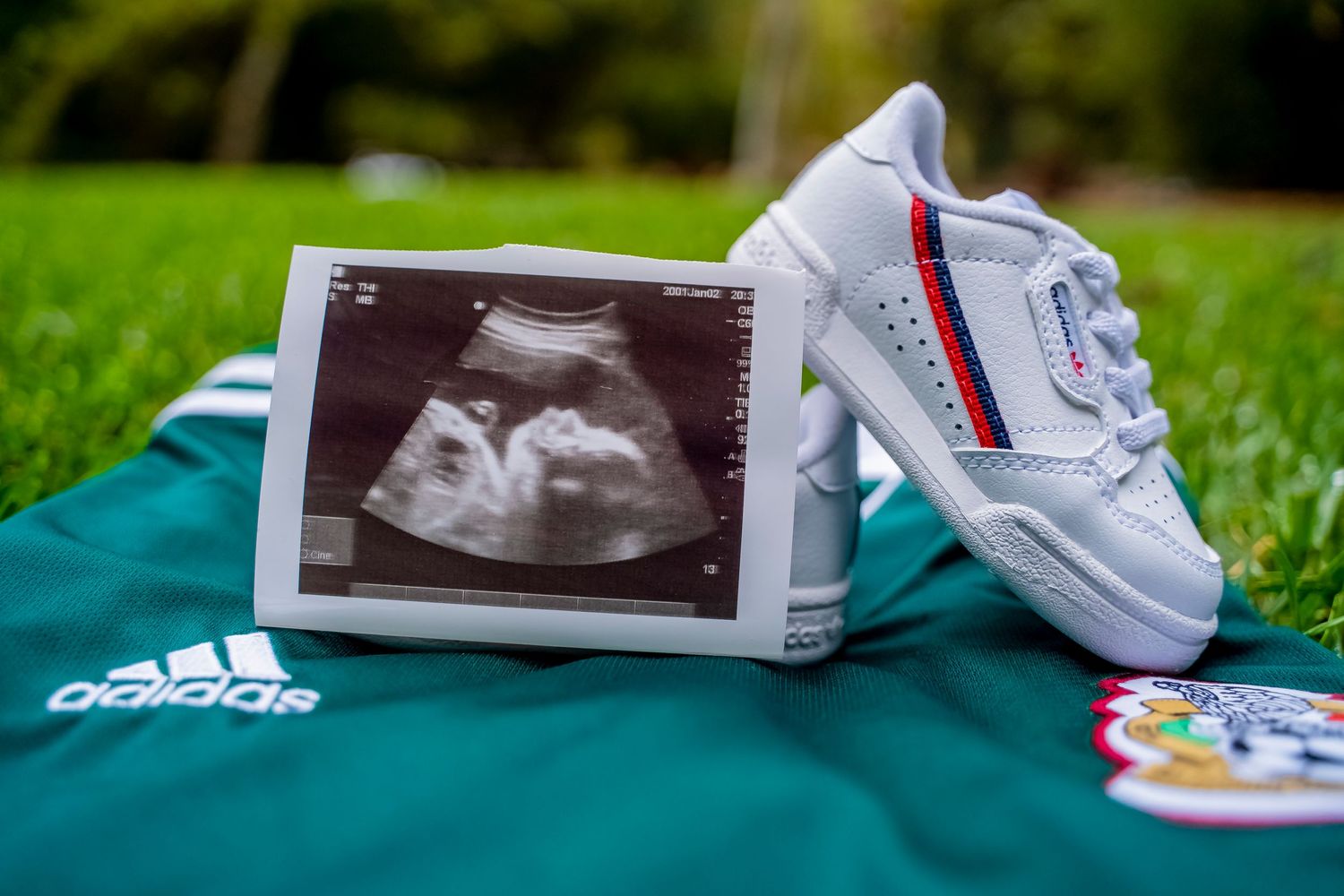 Ultrasound photo and baby shoes displayed on green Adidas sportswear.