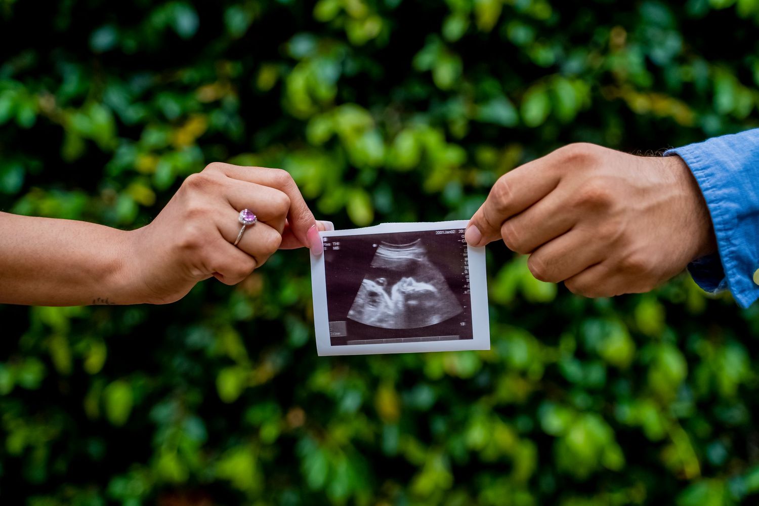 Hands holding ultrasound photo against green foliage background.