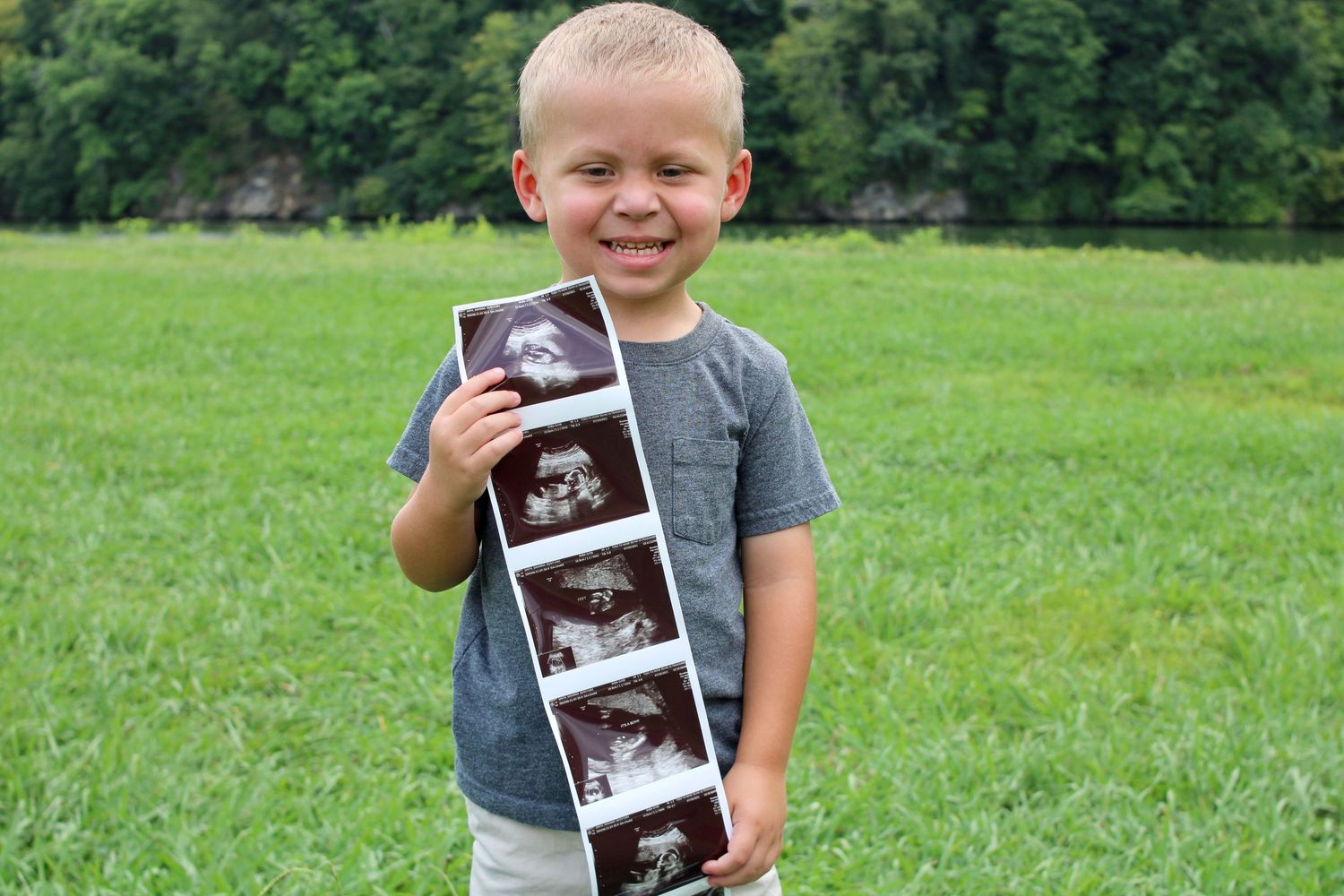 Several ultrasound photos being held up in a grassy outdoor setting.