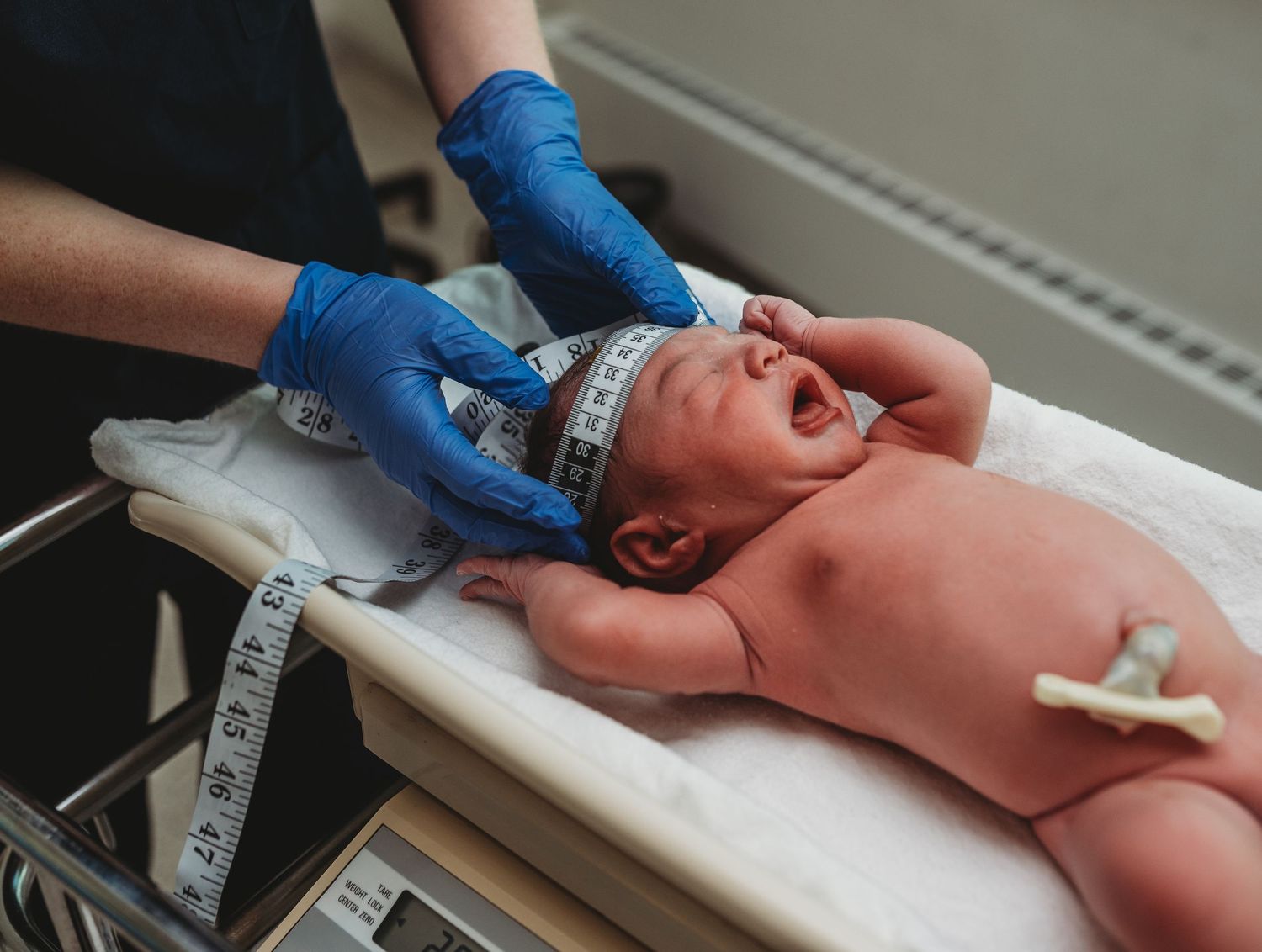 Medical staff performing routine newborn health assessment.