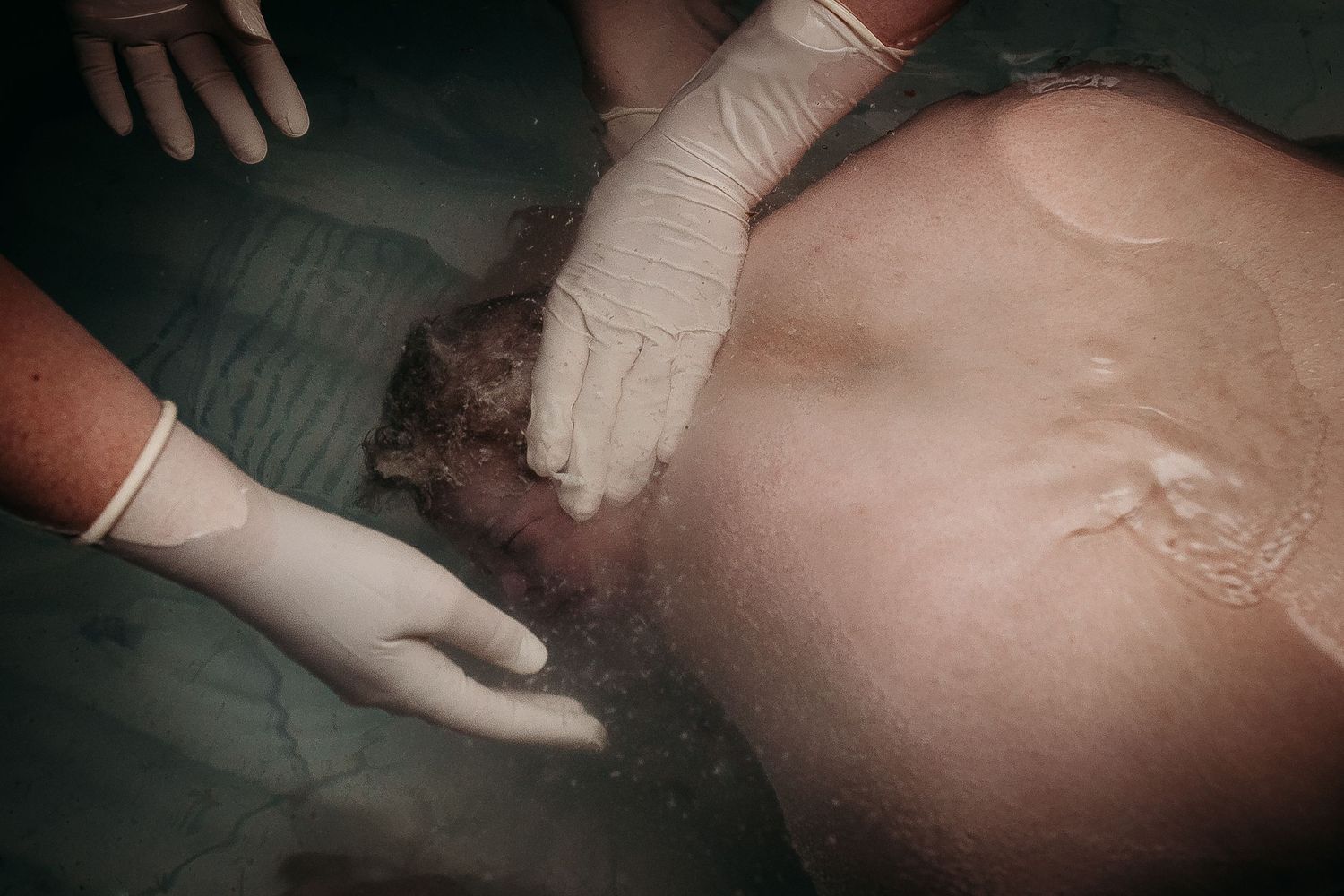 Medical care being provided in low-light clinical setting.