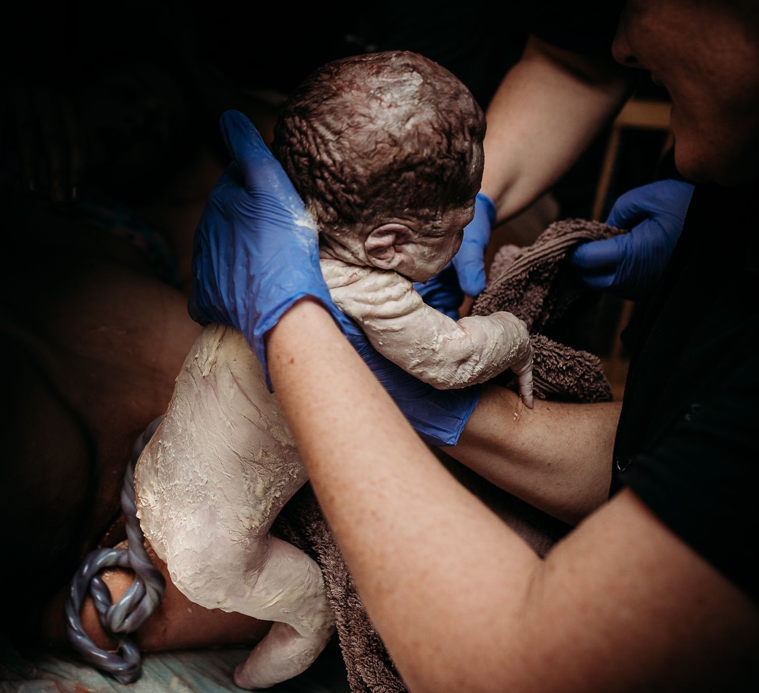 Medical professionals in blue gloves handling newborn during birth.