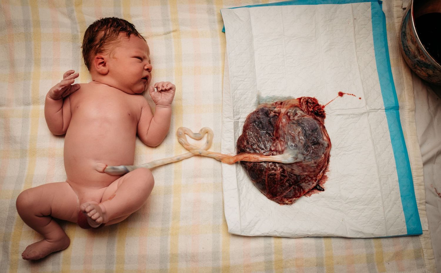 Series of images showing a newborn after birth on medical draping.