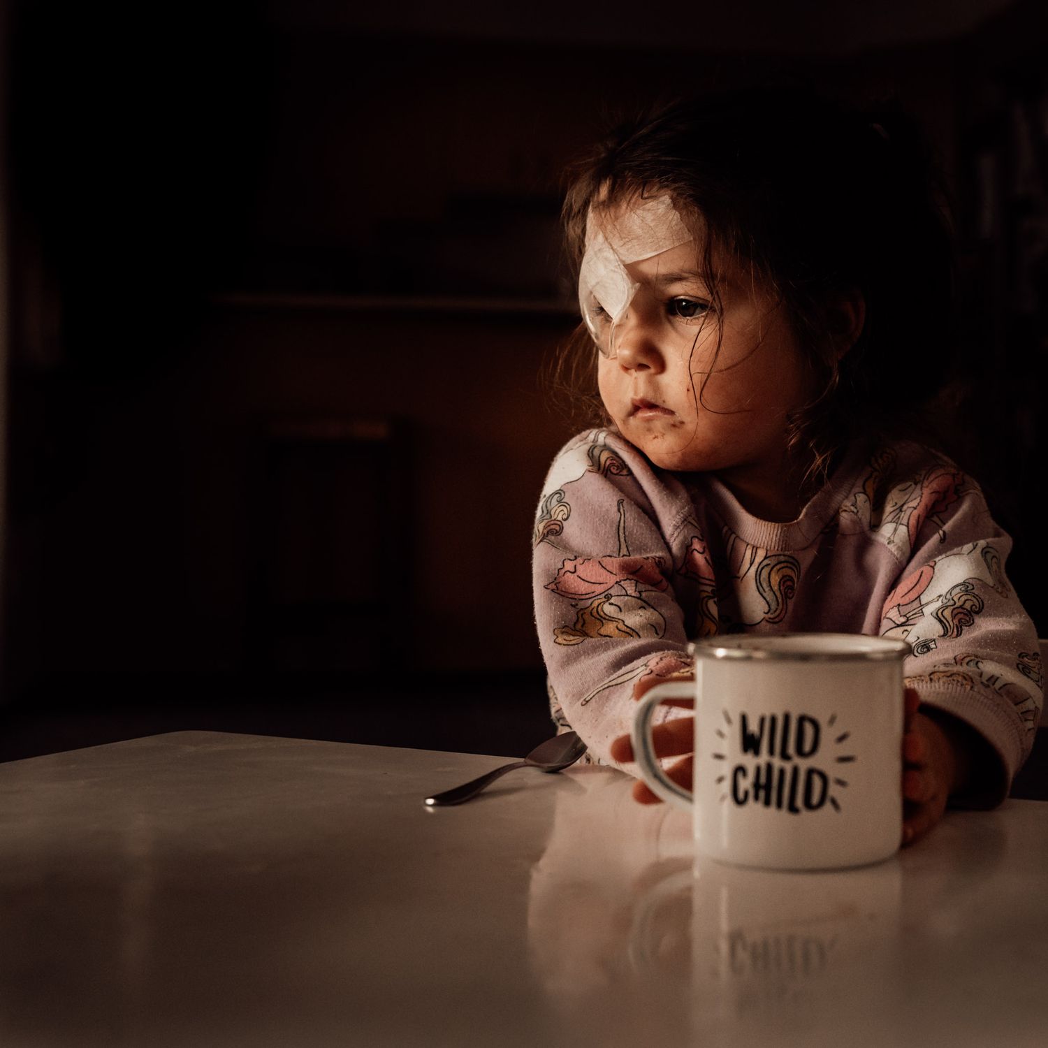 Toddler with eye patch and mug that says Wild Child