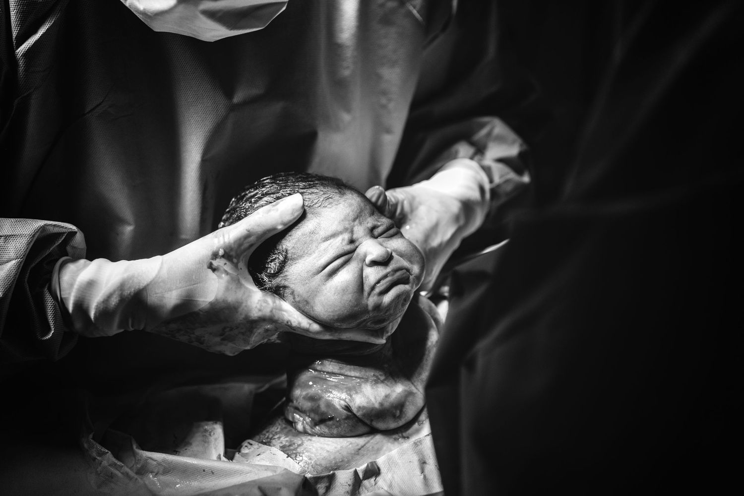 Black and white medical image showing newborn's first moments.