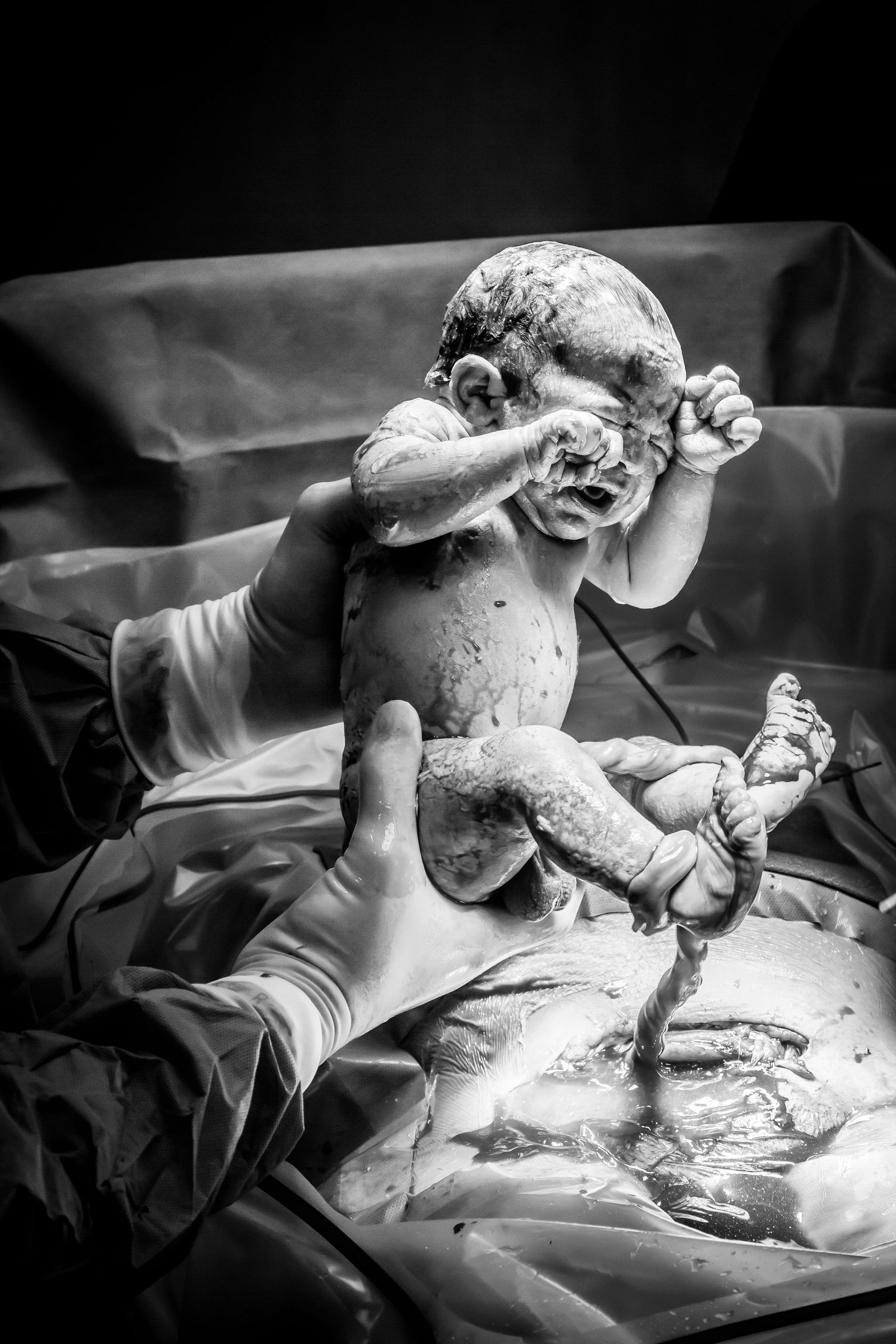 Doctor holds baby in hands in theatre newborn c-section hospital