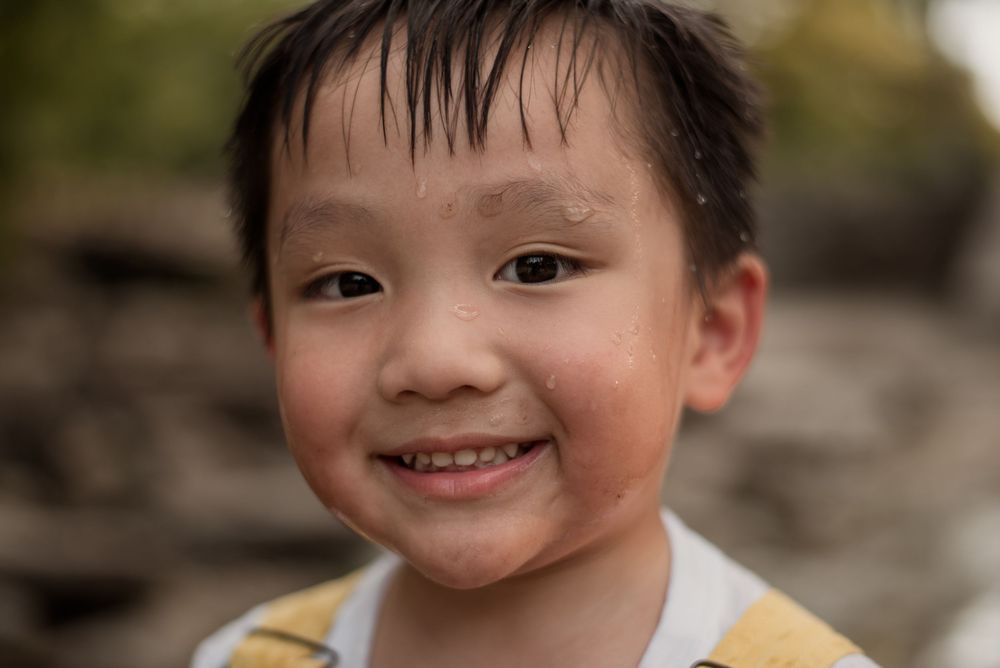Smiling young boy with wet hair and a small bandage on his forehead wears a yellow striped shirt outdoors.