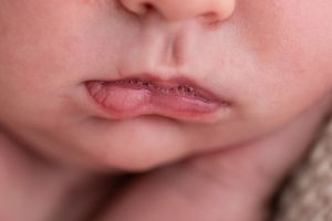 Close-up of a newborn baby's lips and chin showing normal infant mouth features and delicate skin texture.