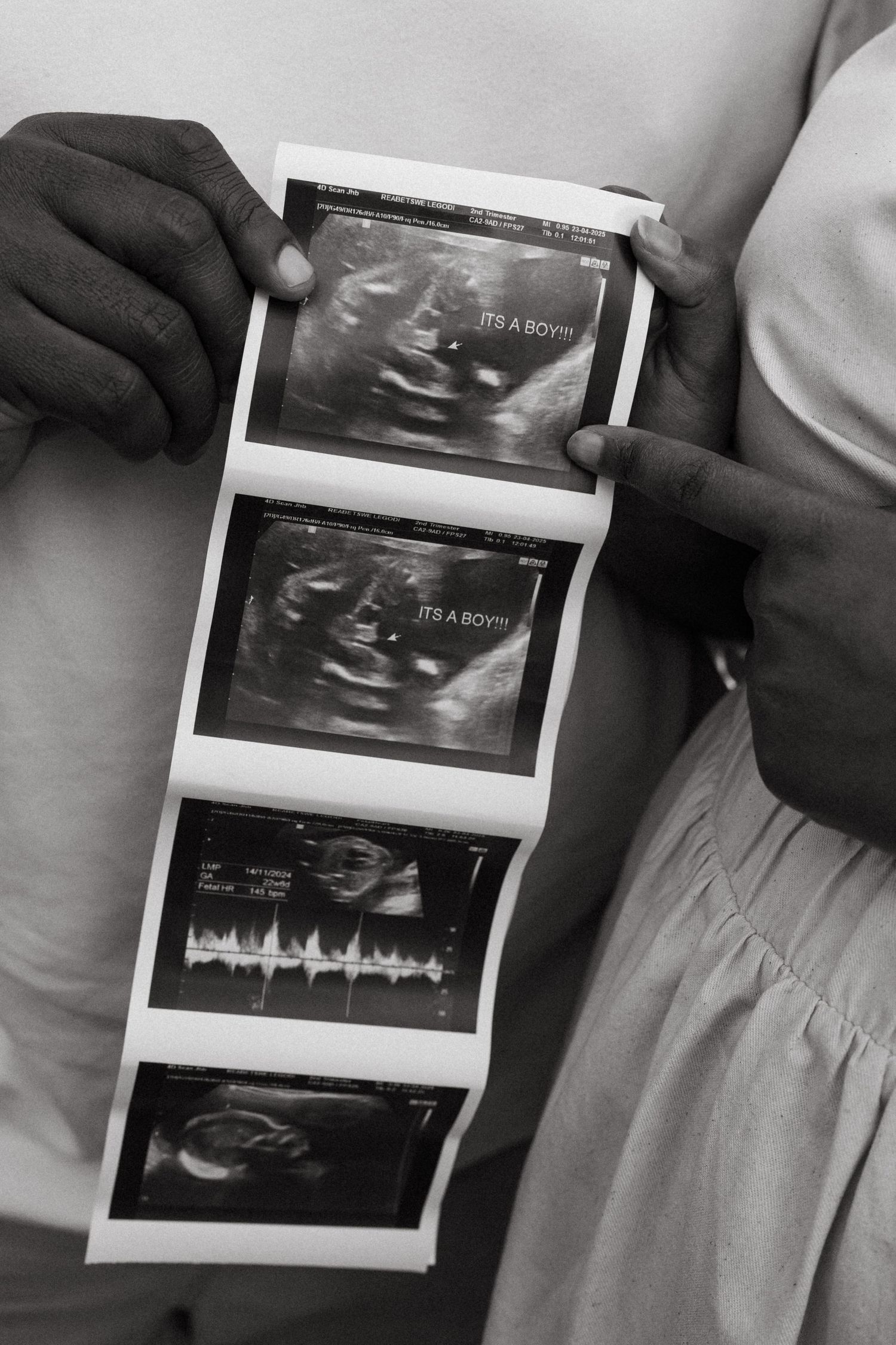 Close-up view of hands holding ultrasound images during pregnancy announcement.