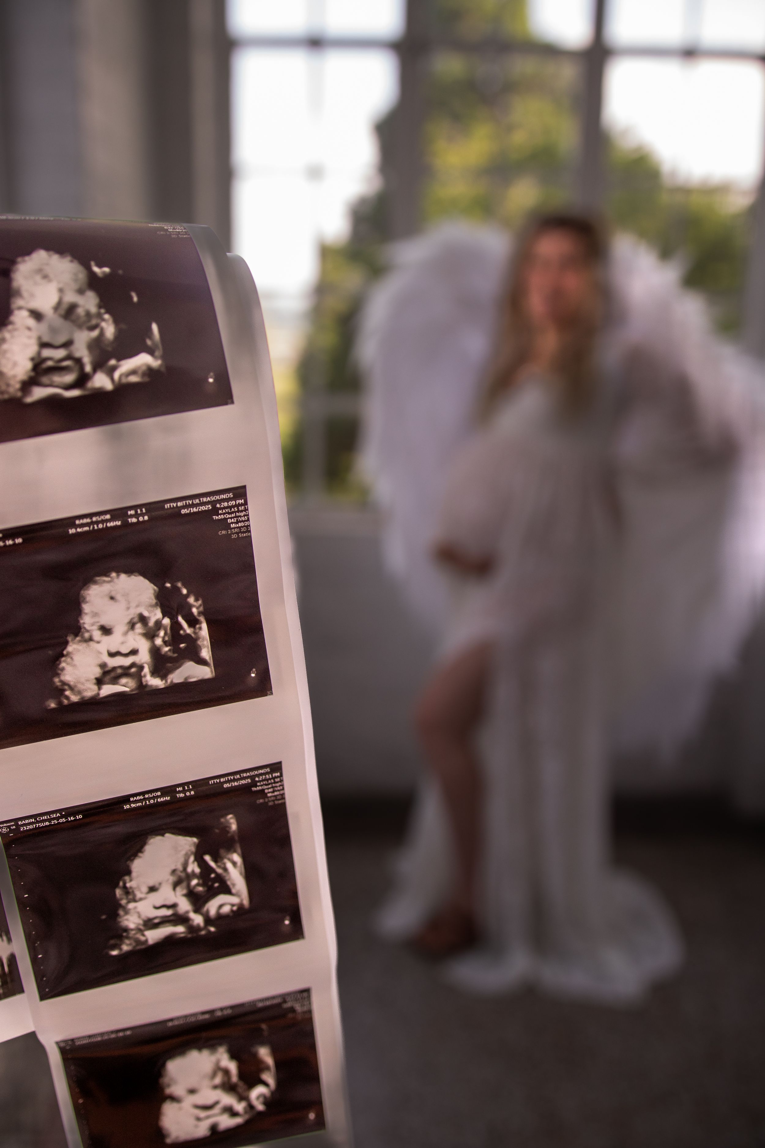 Series of ultrasound images displayed in sequence showing medical diagnostic scans.