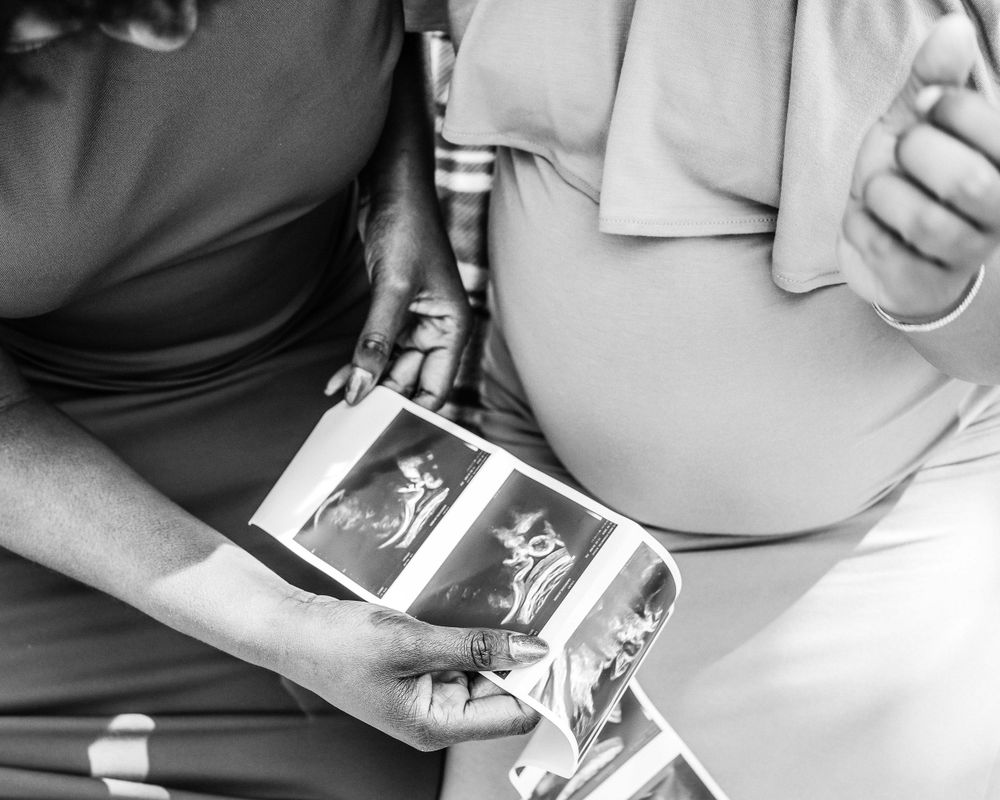 Black and white photo of hands holding ultrasound images.