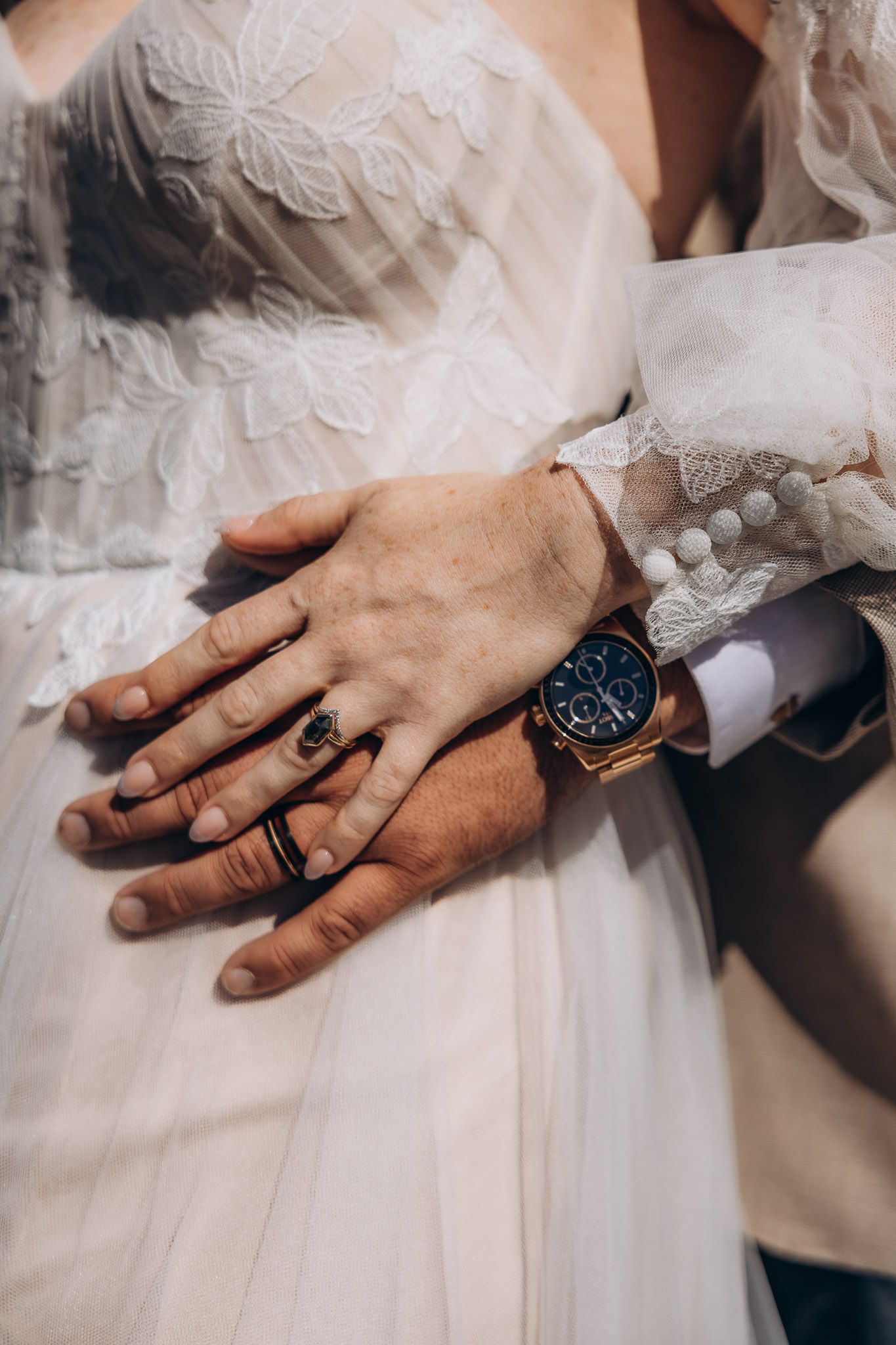 Two hands wearing wedding rings rest against white lace dress fabric with an elegant watch detail.
