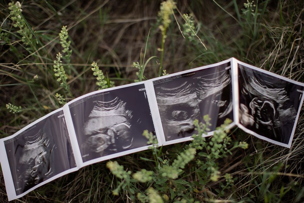 Three black and white ultrasound images laid out in grass showing fetal development scans.