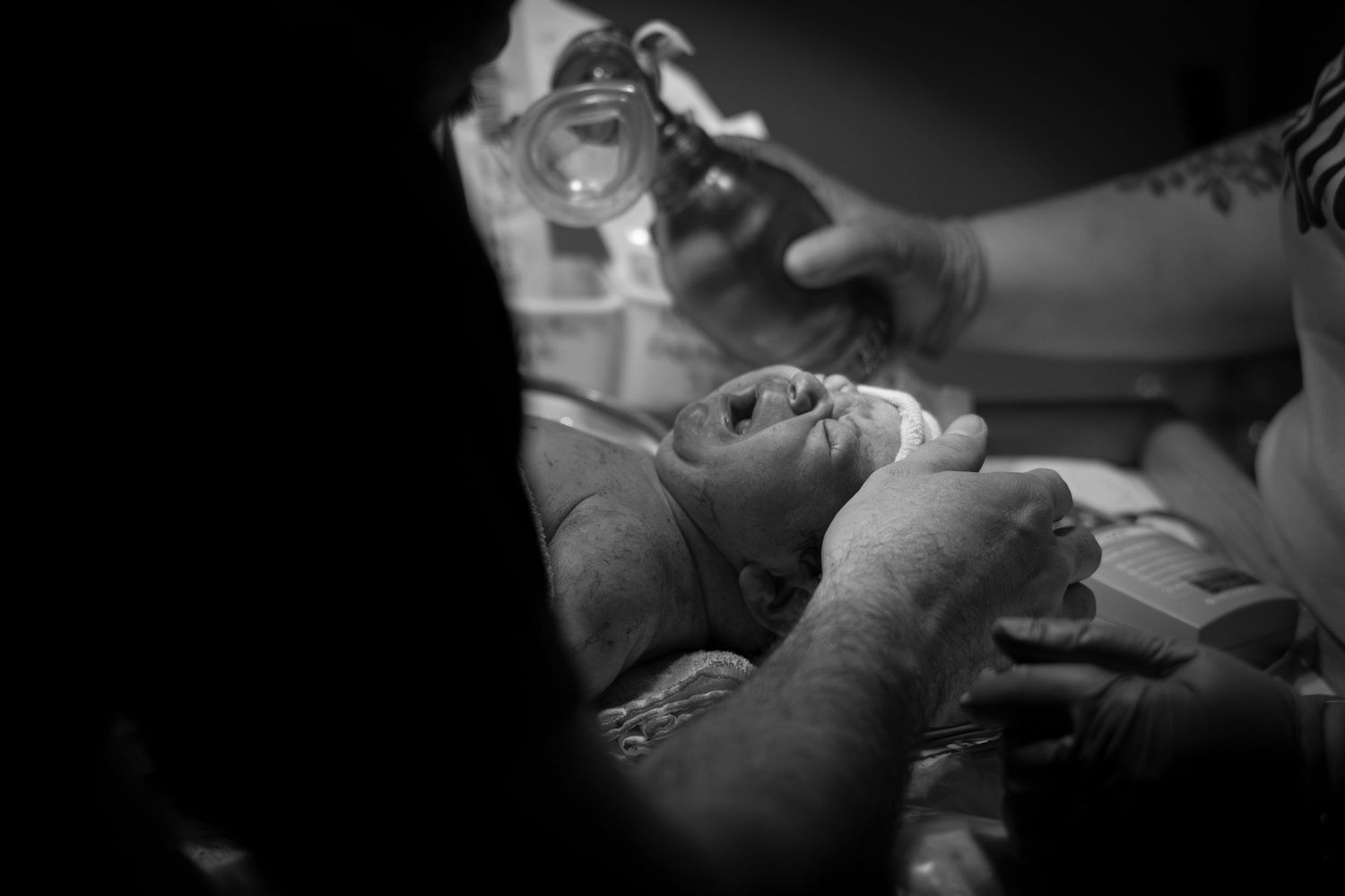 Black and white close-up of a newborn baby receiving medical care after birth.