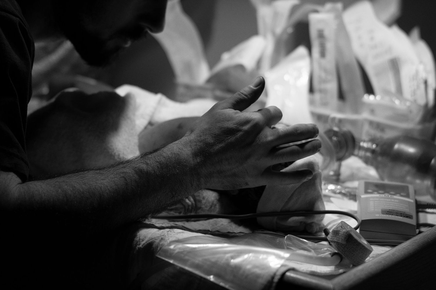 Close-up black and white photo of hands carefully working during a medical procedure.