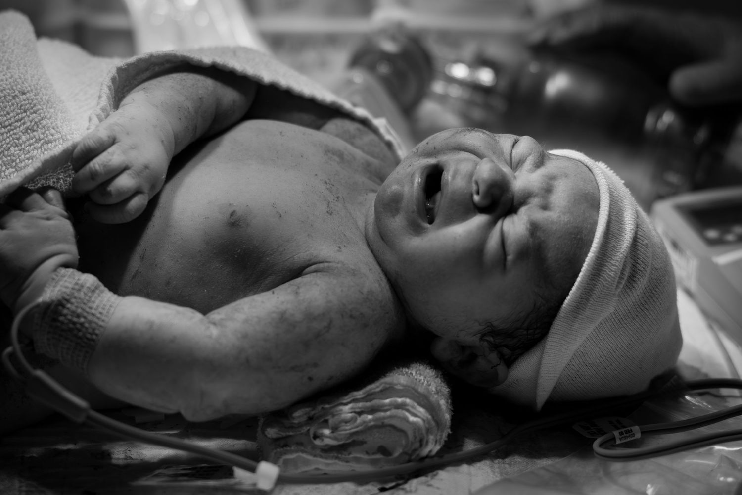 Black and white photo of a newborn baby crying moments after birth.