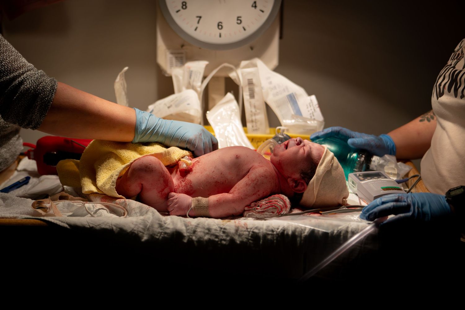 Medical team attending to a newborn baby on a scale under warm lights.