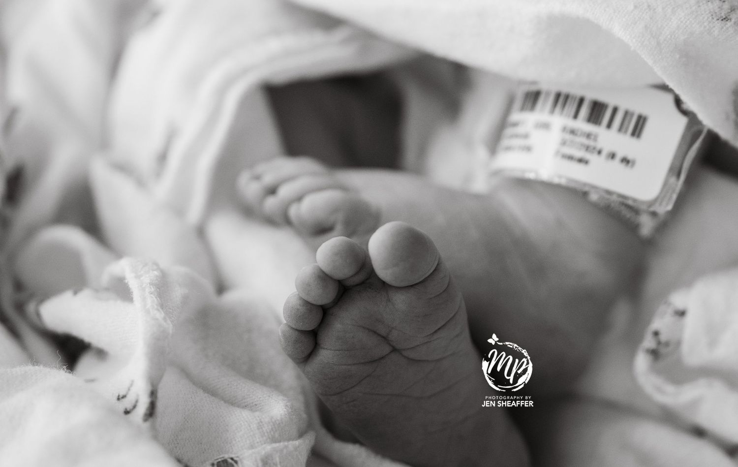 fresh 48 hospital photos toes details