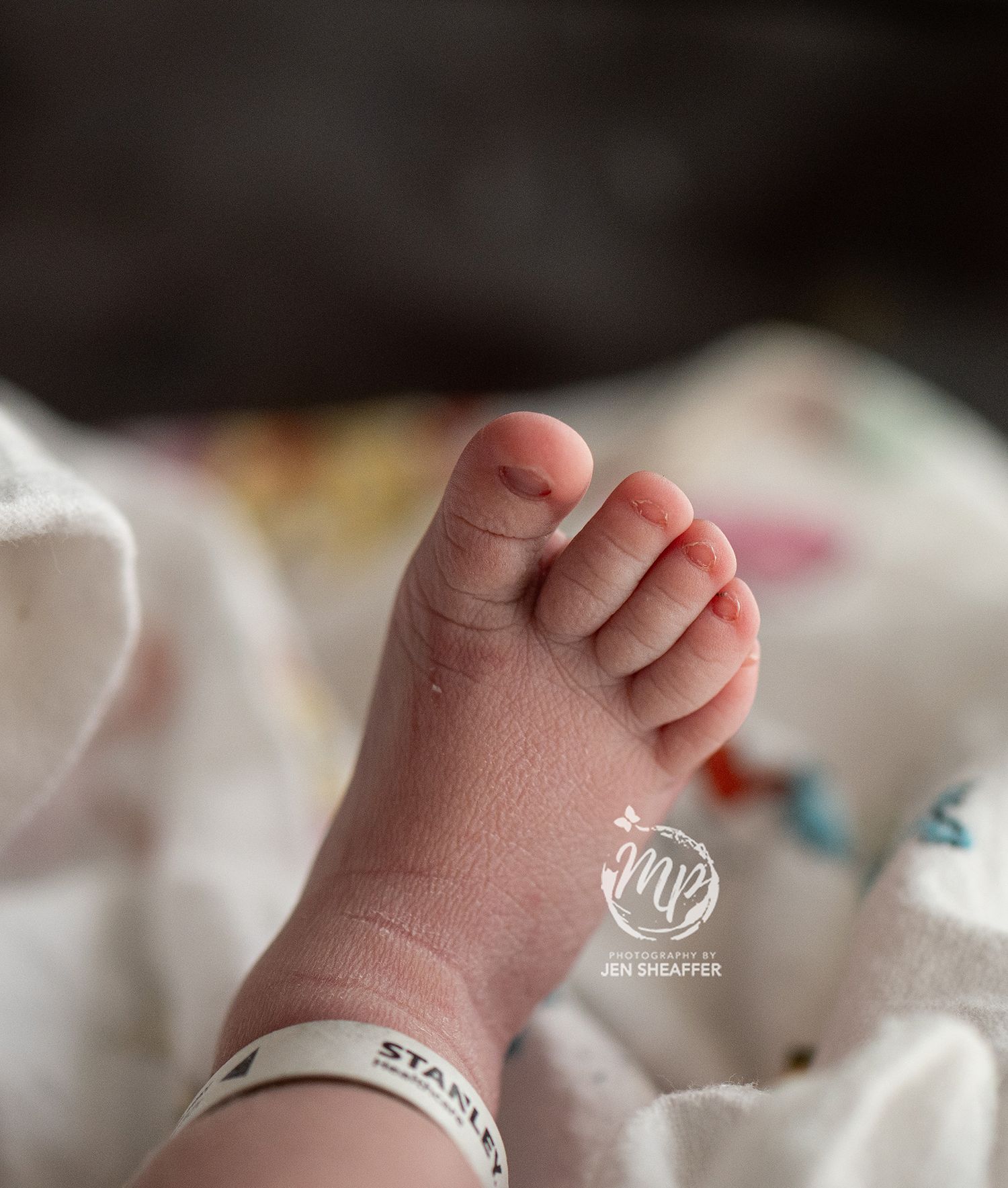 fresh 48 hospital photos toes