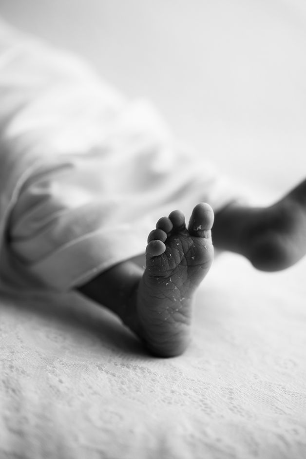 Newborn girl's foot with flaky skin.