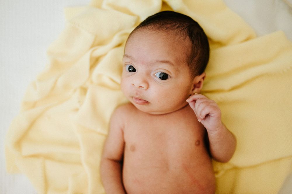 Baby resting on yellow blanket with contemplative expression.