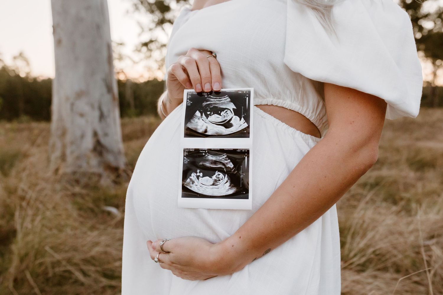 Sharing your exciting news is a moment worth celebrating — and capturing.