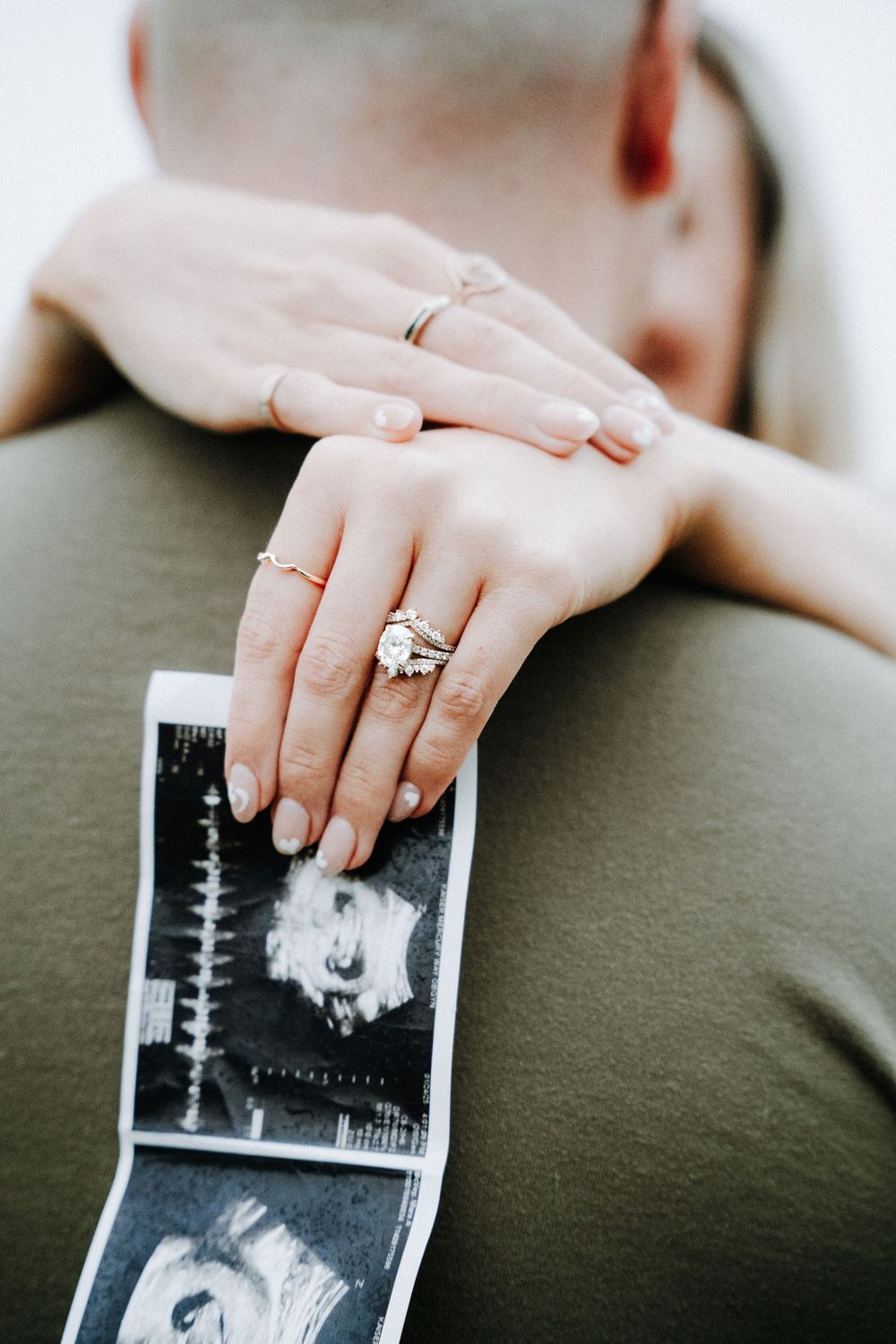 A couple's hands wearing engagement rings rest on a strip of black and white ultrasound photos.