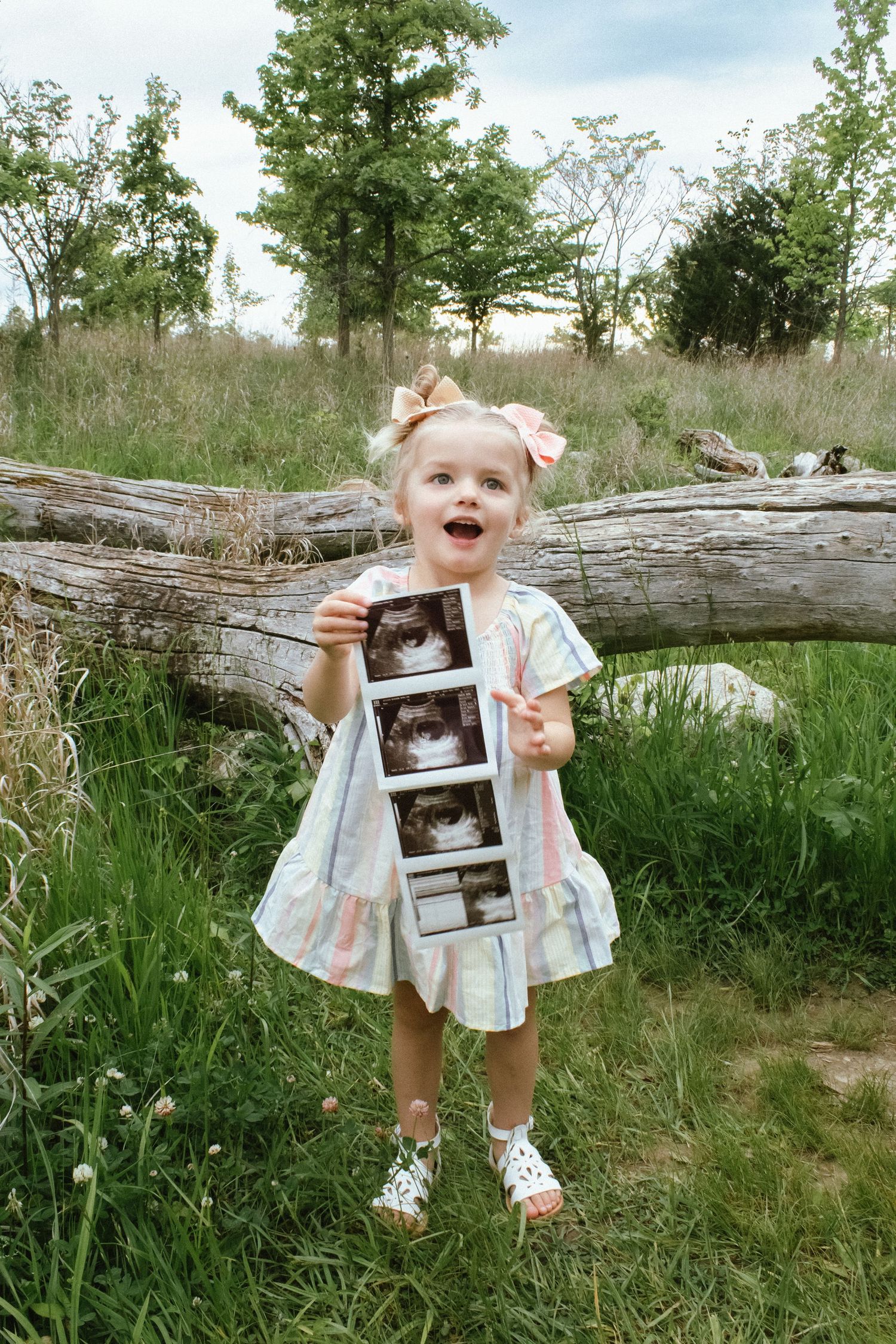 a little girl excited to become a big sister
