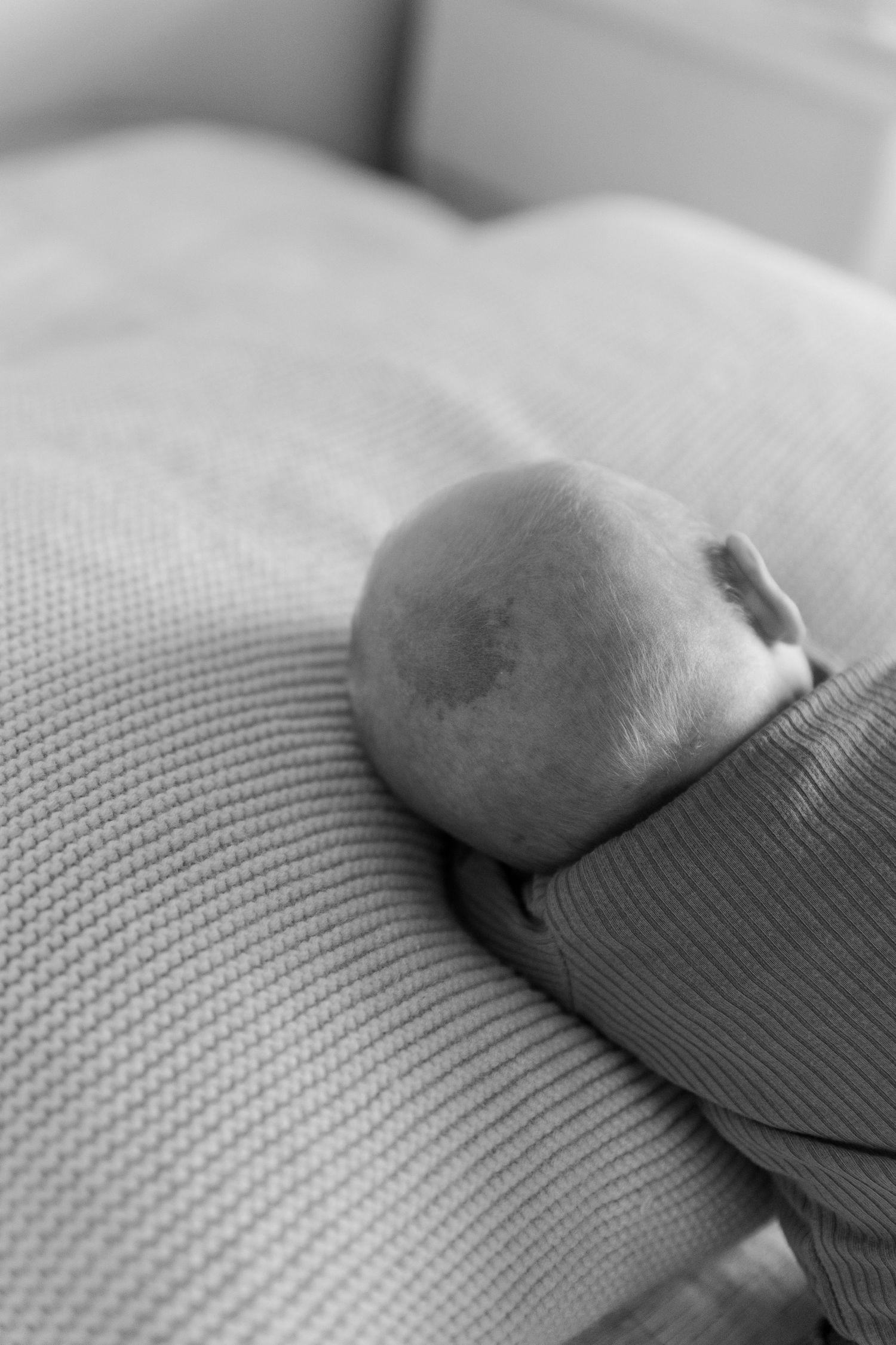 black and white babys birthmark on the back of his head