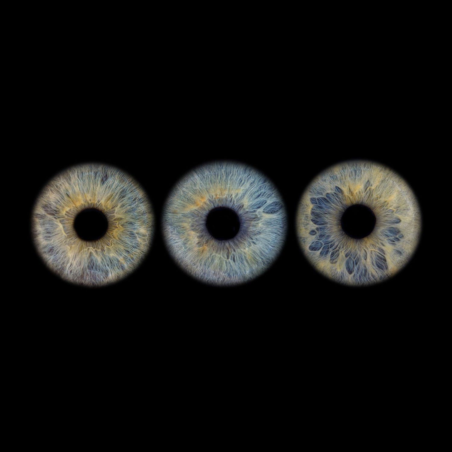 Sequence showing iris anatomy microscopic images with darkening contrast from left to right.