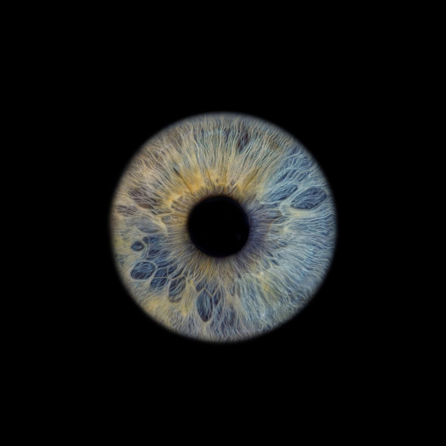 A detailed macro photograph of a blue and gold human iris with intricate patterns against a black background.