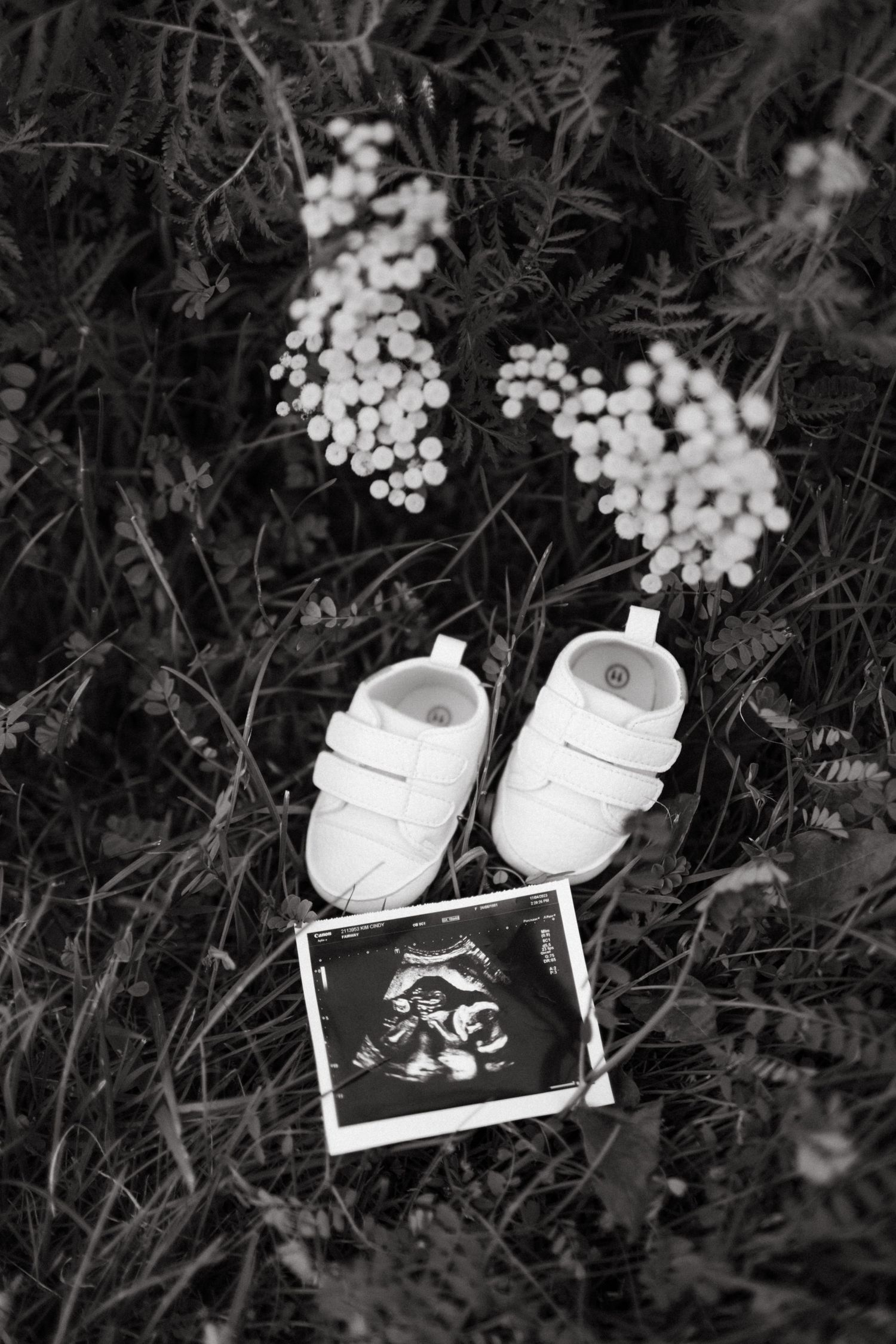Black and white pregnancy announcement photo with baby shoes and ultrasound image placed among delicate white flowers in Guelph Ontario