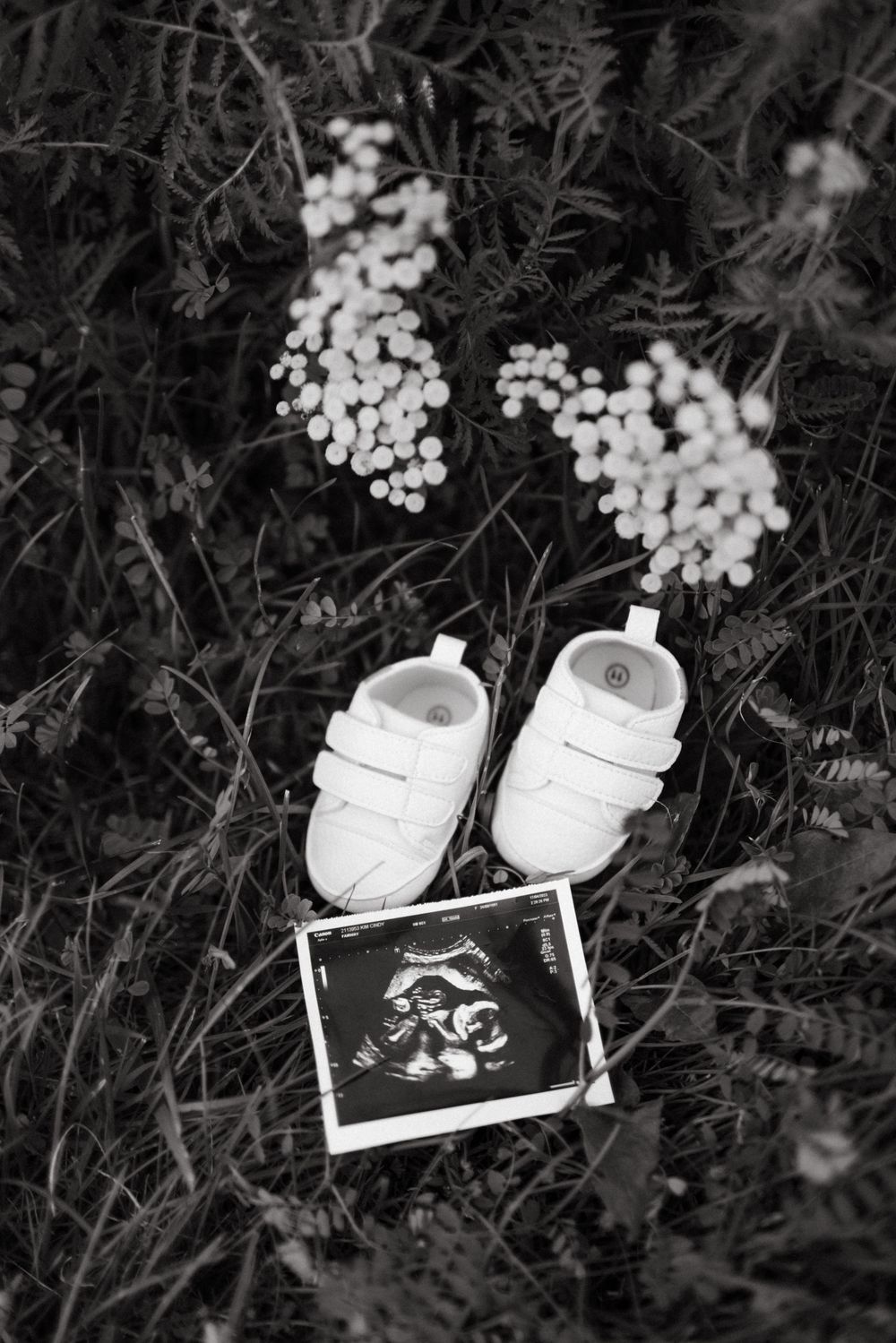 Black and white pregnancy announcement photo with baby shoes and ultrasound image placed among delicate white flowers in Guelph Ontario