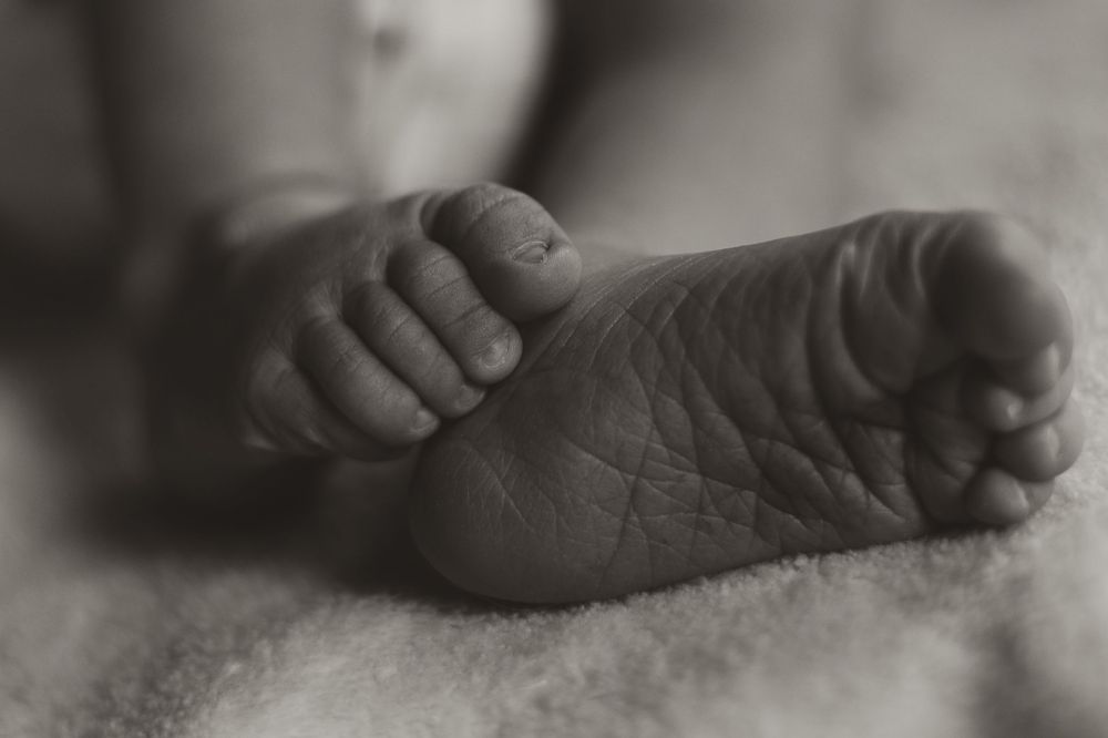 Eight progress photos show a baby's foot gradually shrinking and changing colors as it undergoes revascularization treatment.