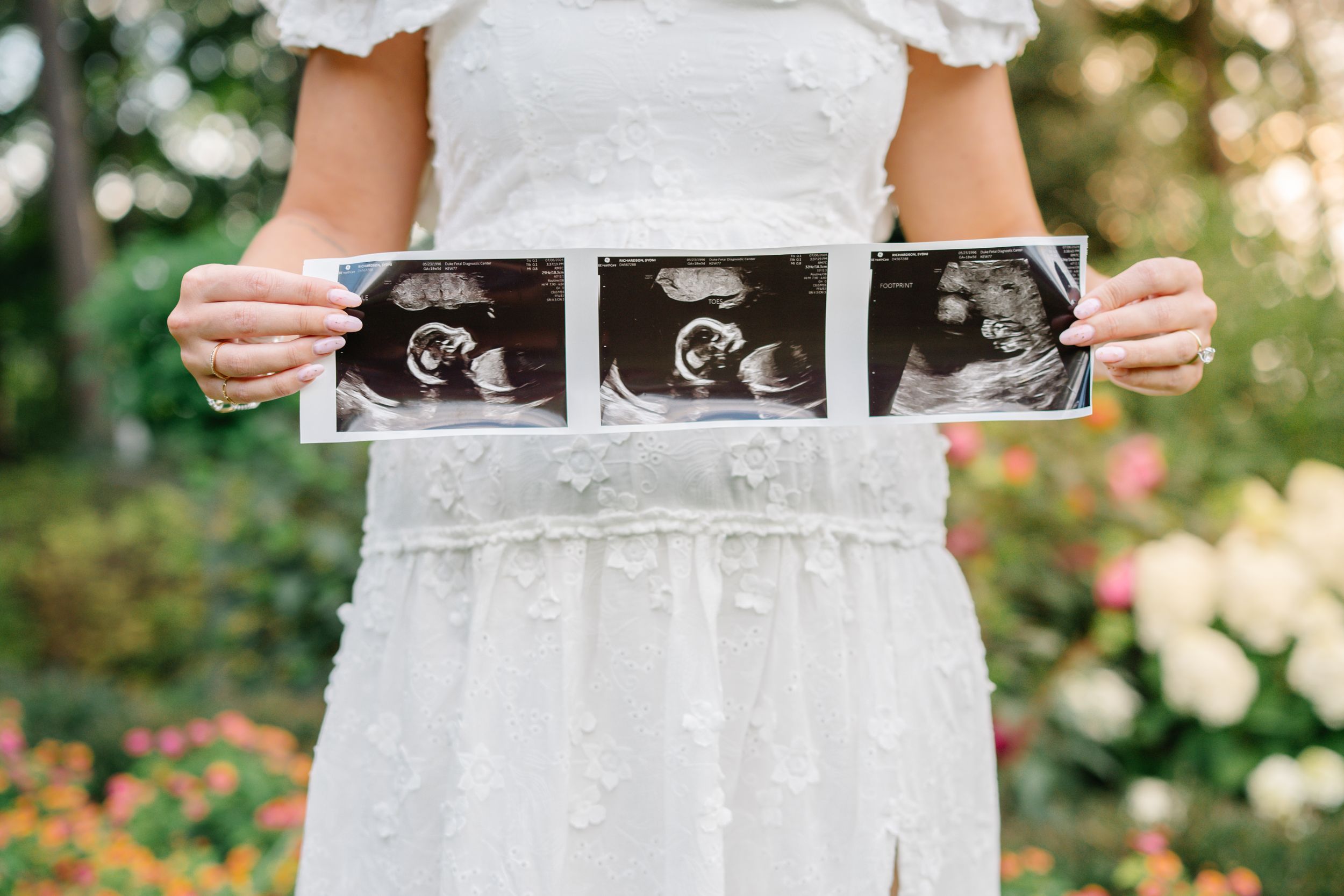 Pregnant woman in white dress holding ultrasound sonogram photos outdoors in a garden setting.