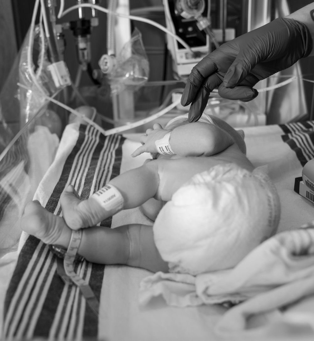 Black and white photo of a premature newborn baby in a NICU incubator with medical equipment and a gloved hand nearby.