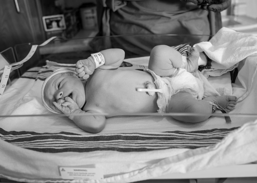 Black and white photo of a newborn baby lying in a hospital bassinet with medical equipment attached.