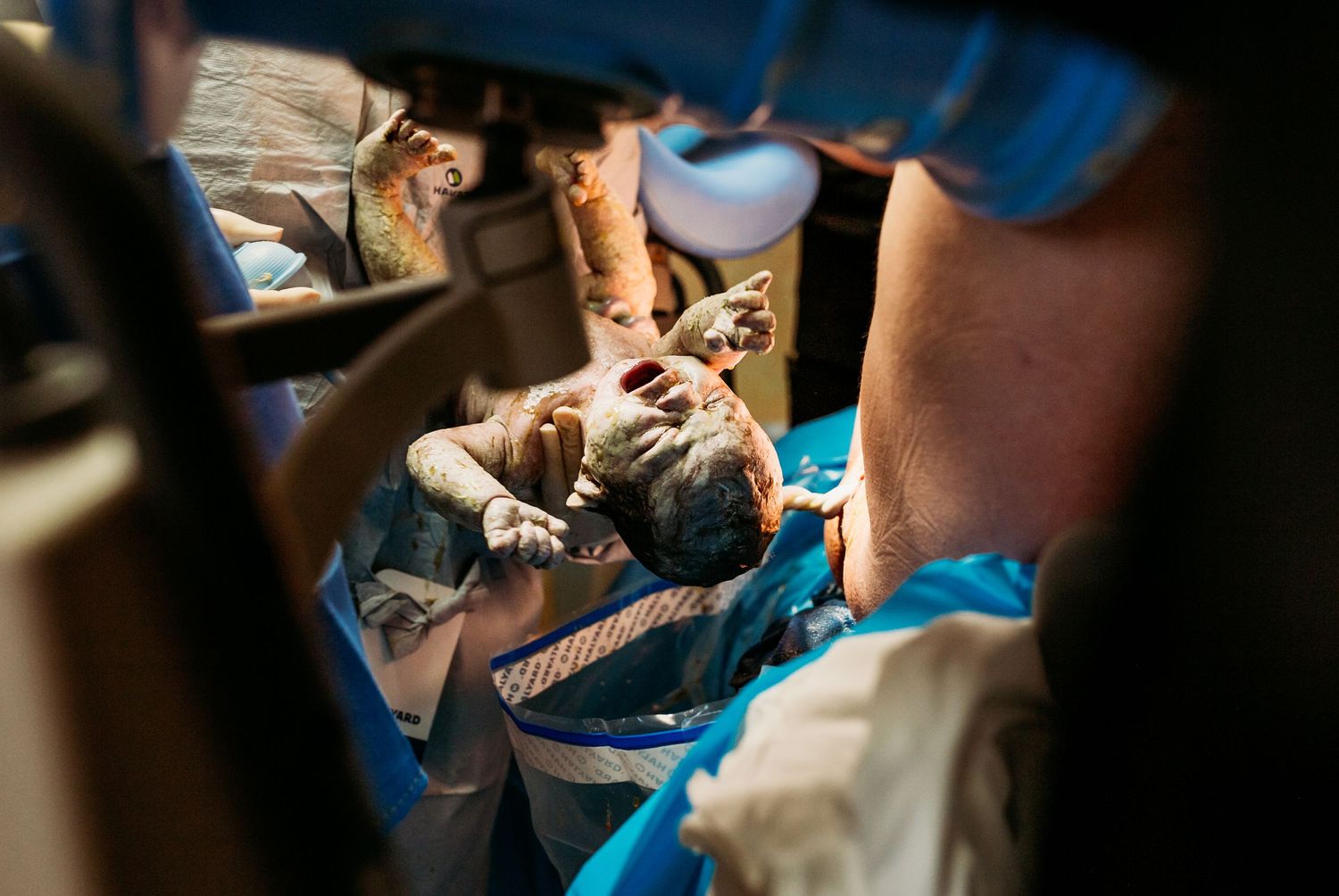 Newborn baby boy being delivered at st.John hospital in Tulsa,ok
