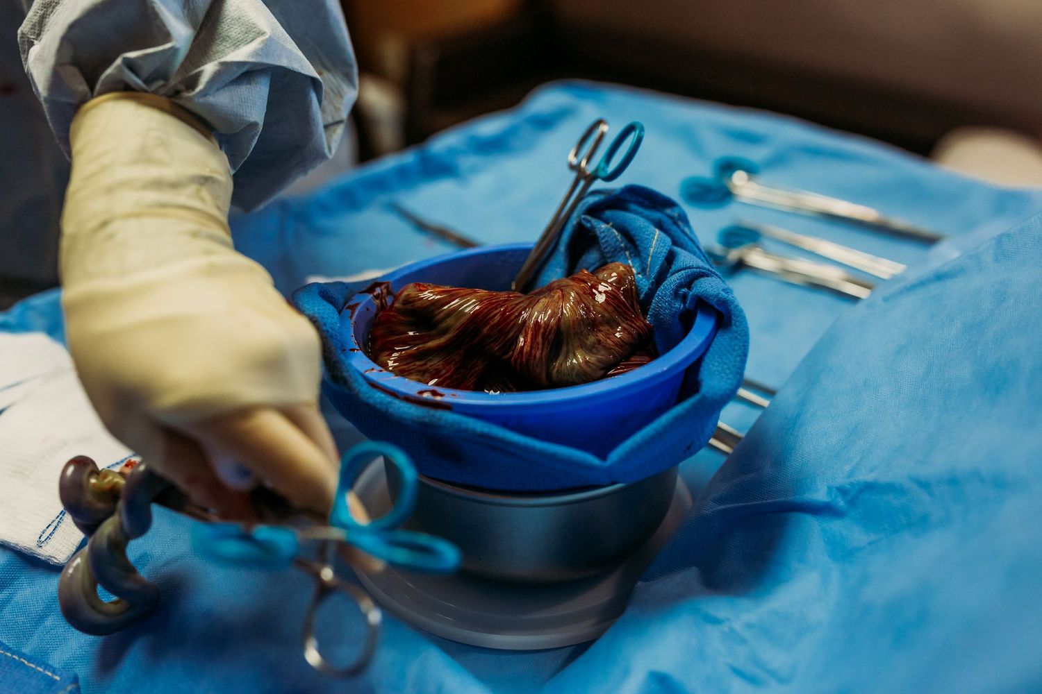 placenta after birth at St.John Hospital in Tulsa, Tulsa birth photographer