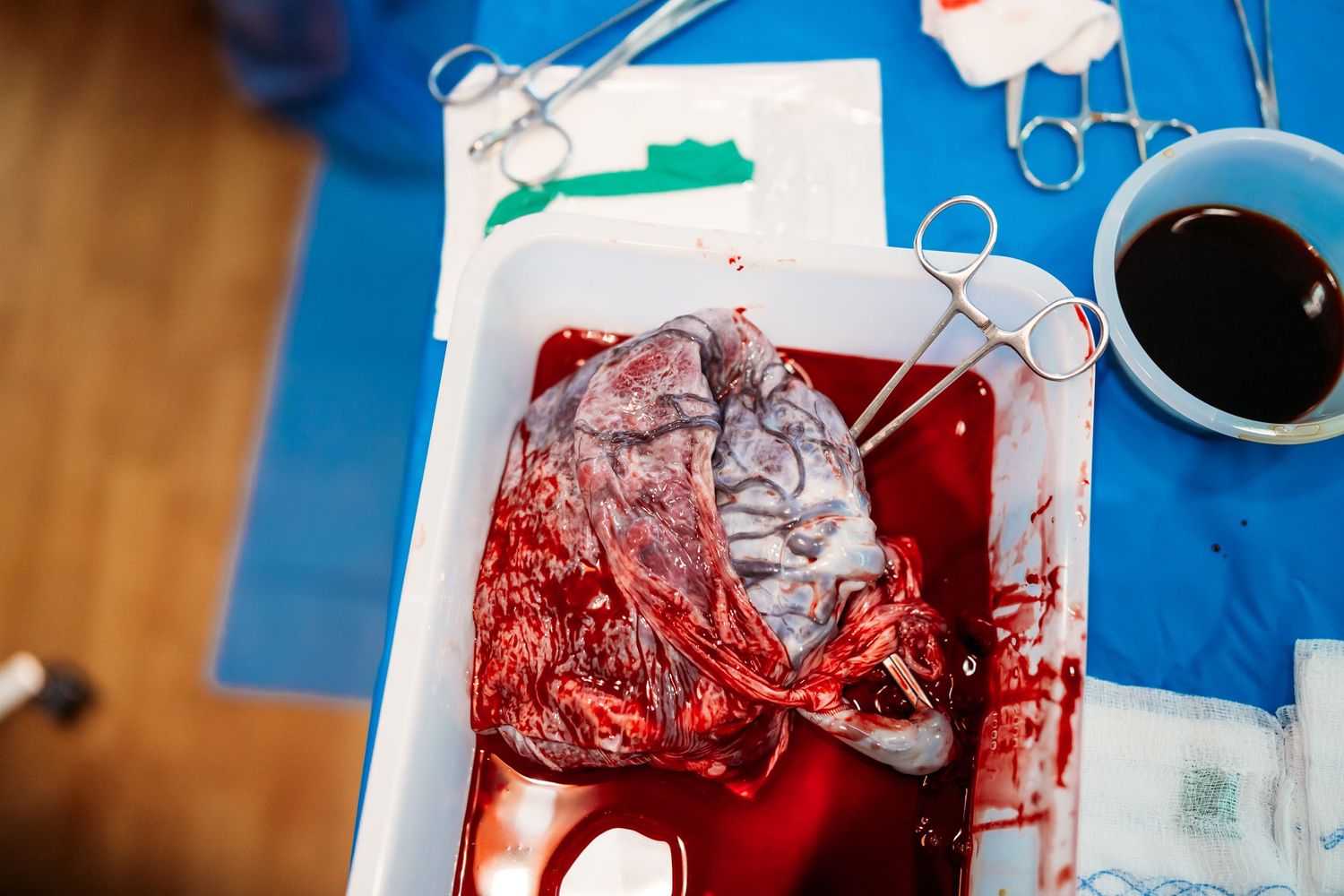 Placenta after birth captured by birth photographer