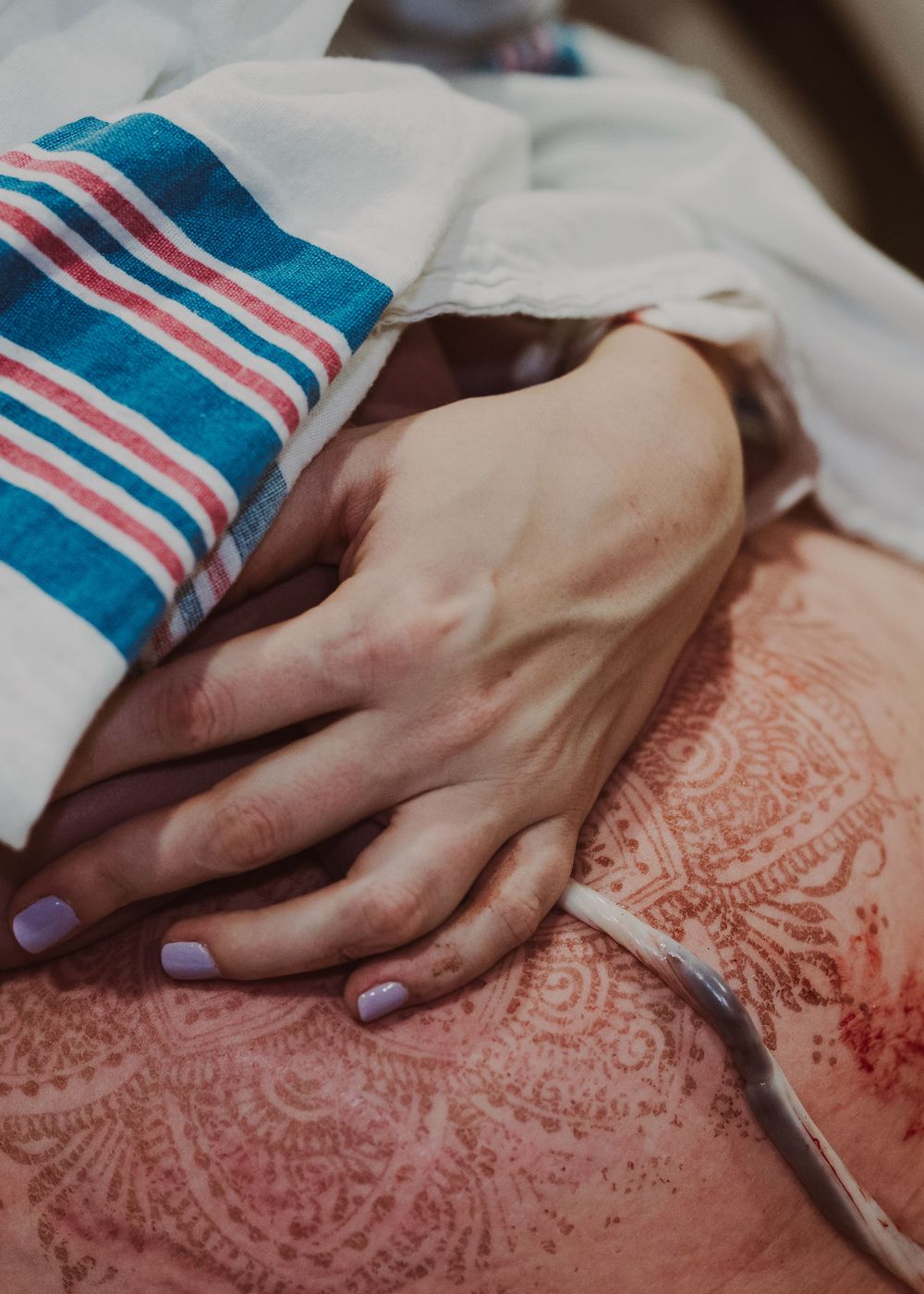 Close-up of a hand resting on a hospital blanket with intricate henna designs visible.
